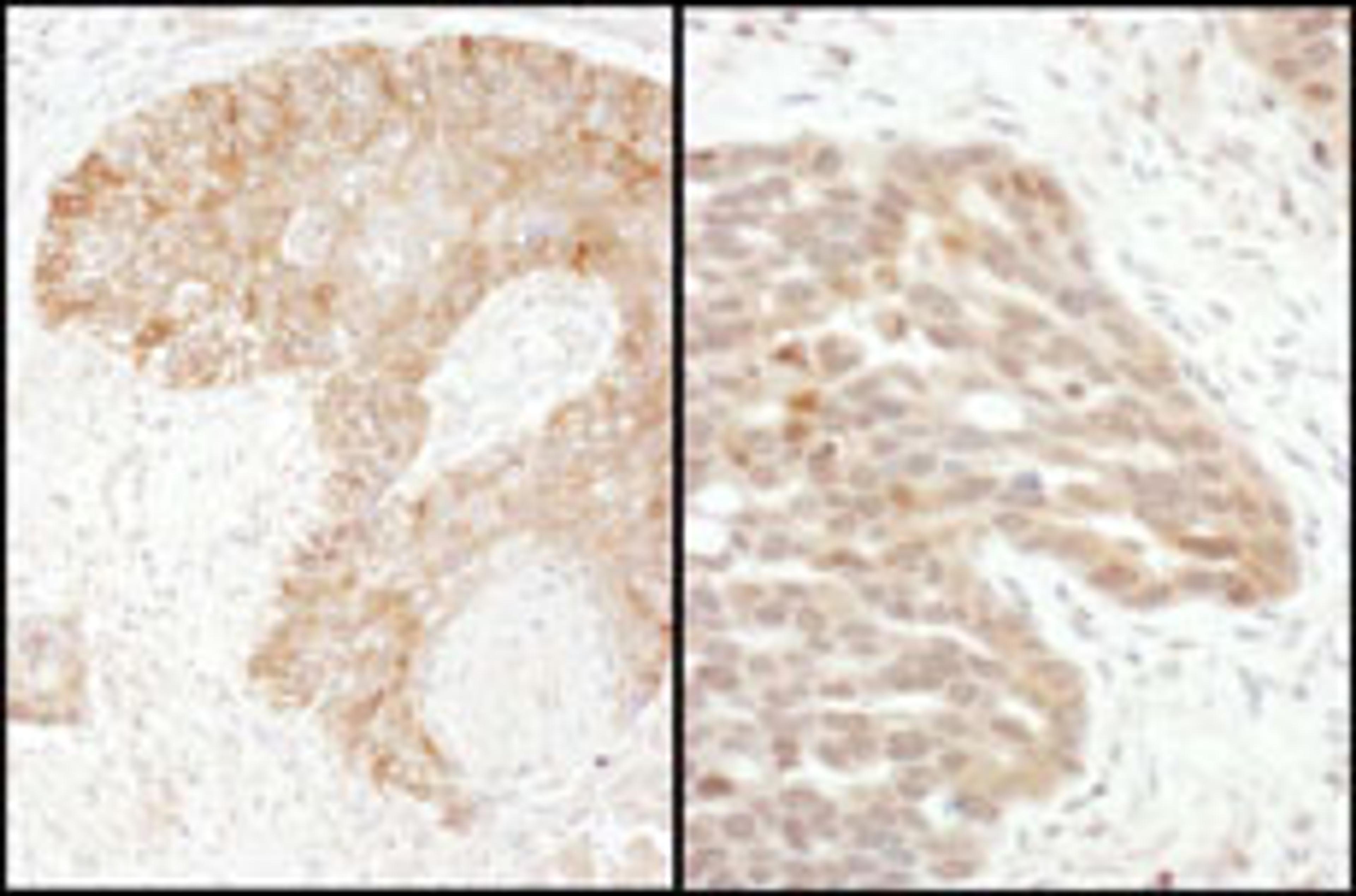 Detection of human TS by immunohistochemistry.