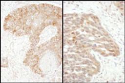 Detection of human TS by immunohistochemistry.