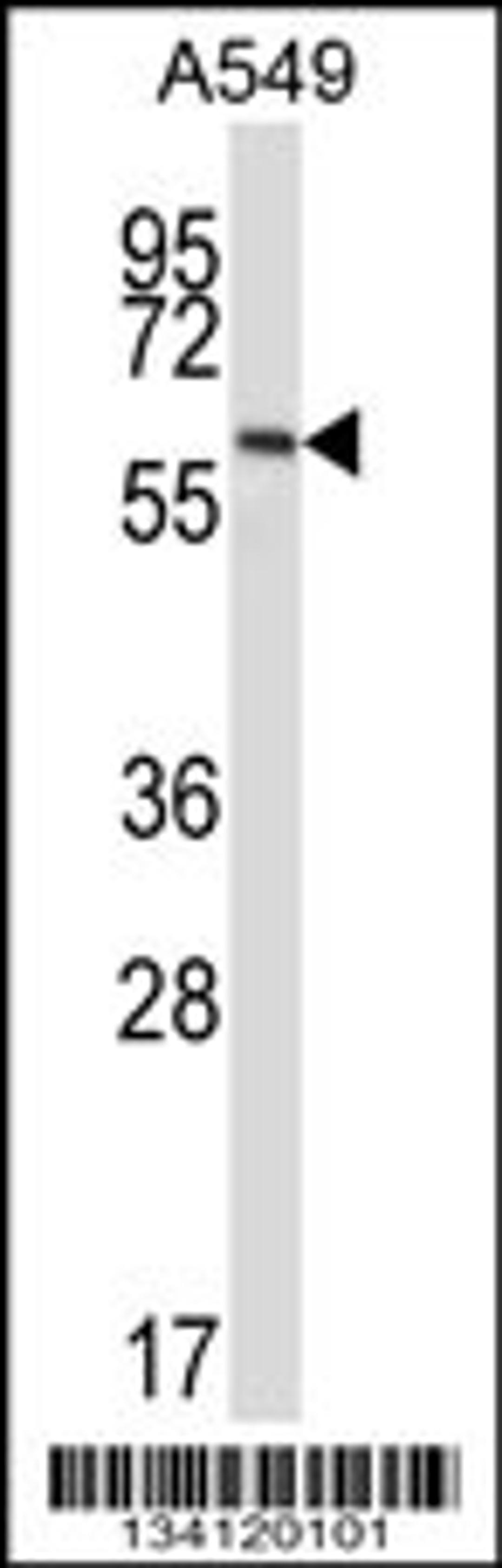 Western blot analysis in A549 cell line lysates (35ug/lane).