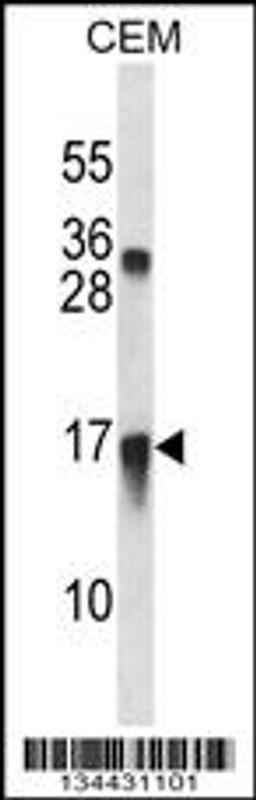 Western blot analysis in CEM cell line lysates (35ug/lane).