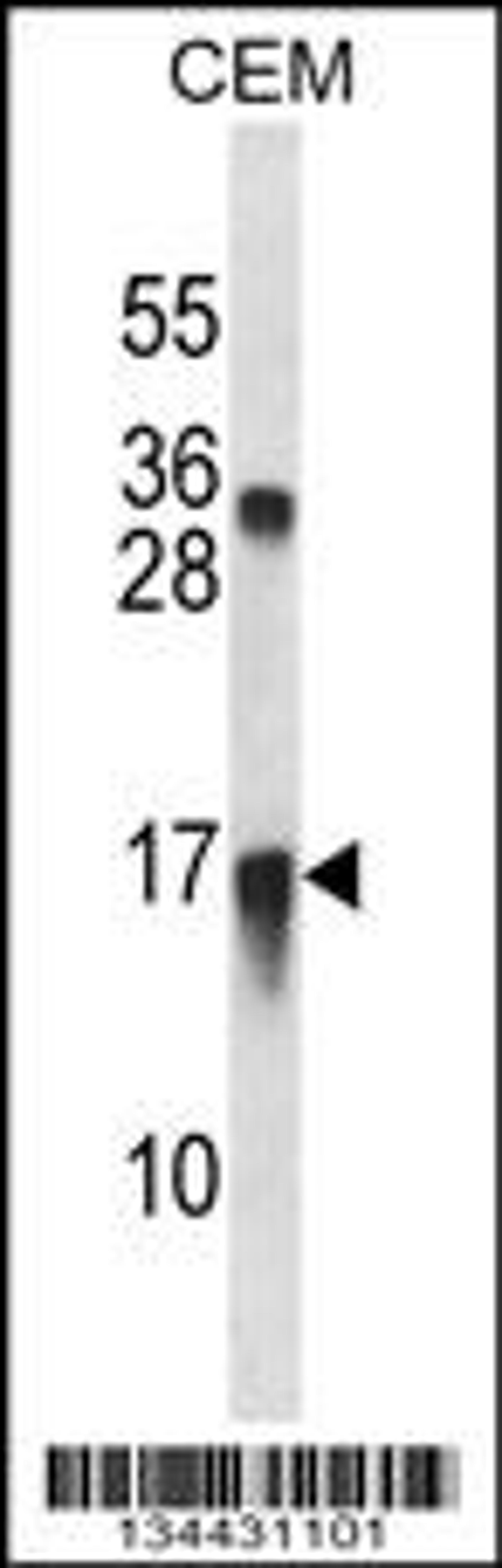 Western blot analysis in CEM cell line lysates (35ug/lane).