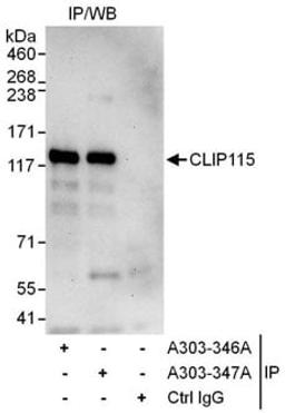 Detection of human CLIP115 by western blot of immunoprecipitates.