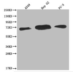 Western Blot. Positive WB detected in: A549 whole cell lysate, HepG2 whole cell lysate, PC3 whole cell lysate. All lanes: USP22 antibody at 1:2000. Secondary. Goat polyclonal to rabbit IgG at 1/50000 dilution. Predicted band size: 60, 59 kDa. Observed band size: 55-72 kDa. 