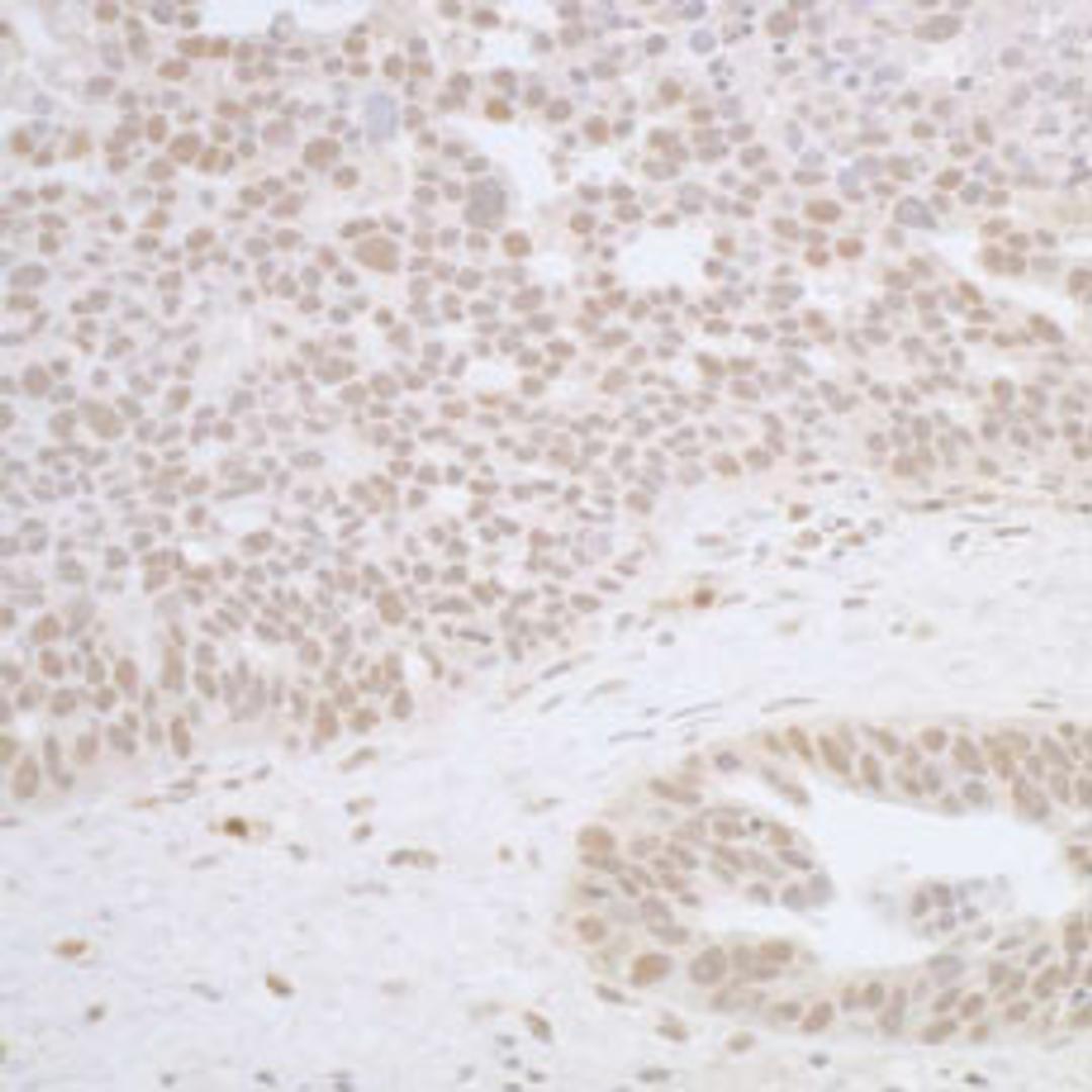 Detection of human RFX1 by immunohistochemistry.