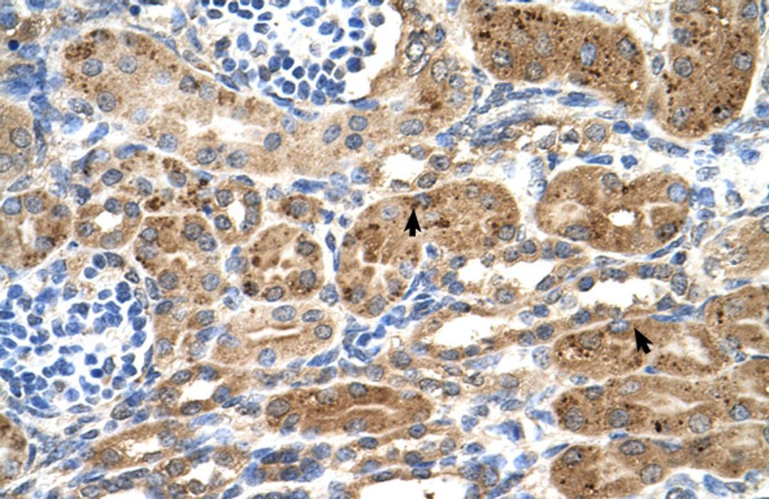 Antibody used in IHC on Human kidney.