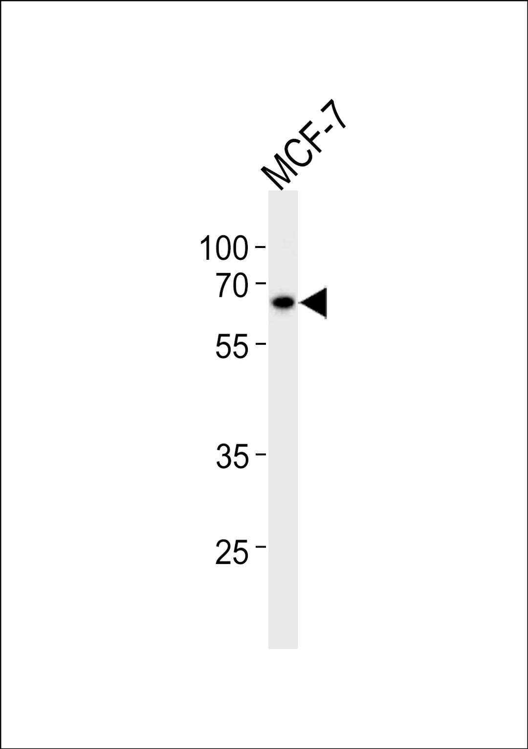 Western blot analysis in MCF-7 cell line lysates (35ug/lane).