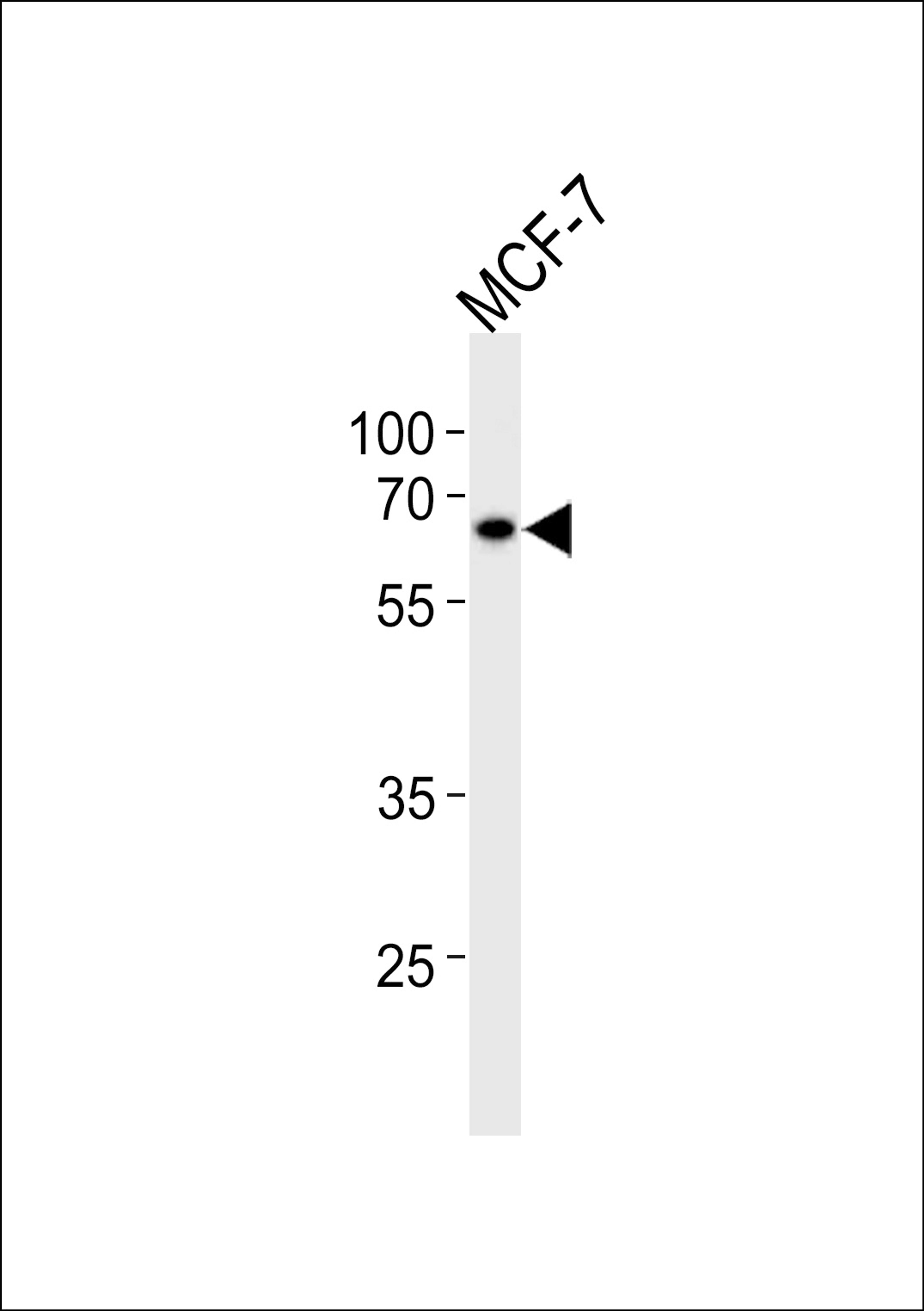 Western blot analysis in MCF-7 cell line lysates (35ug/lane).