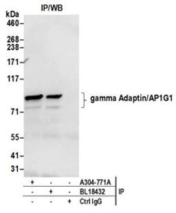 Detection of human gamma Adaptin/AP1G1 by western blot of immunoprecipitates.