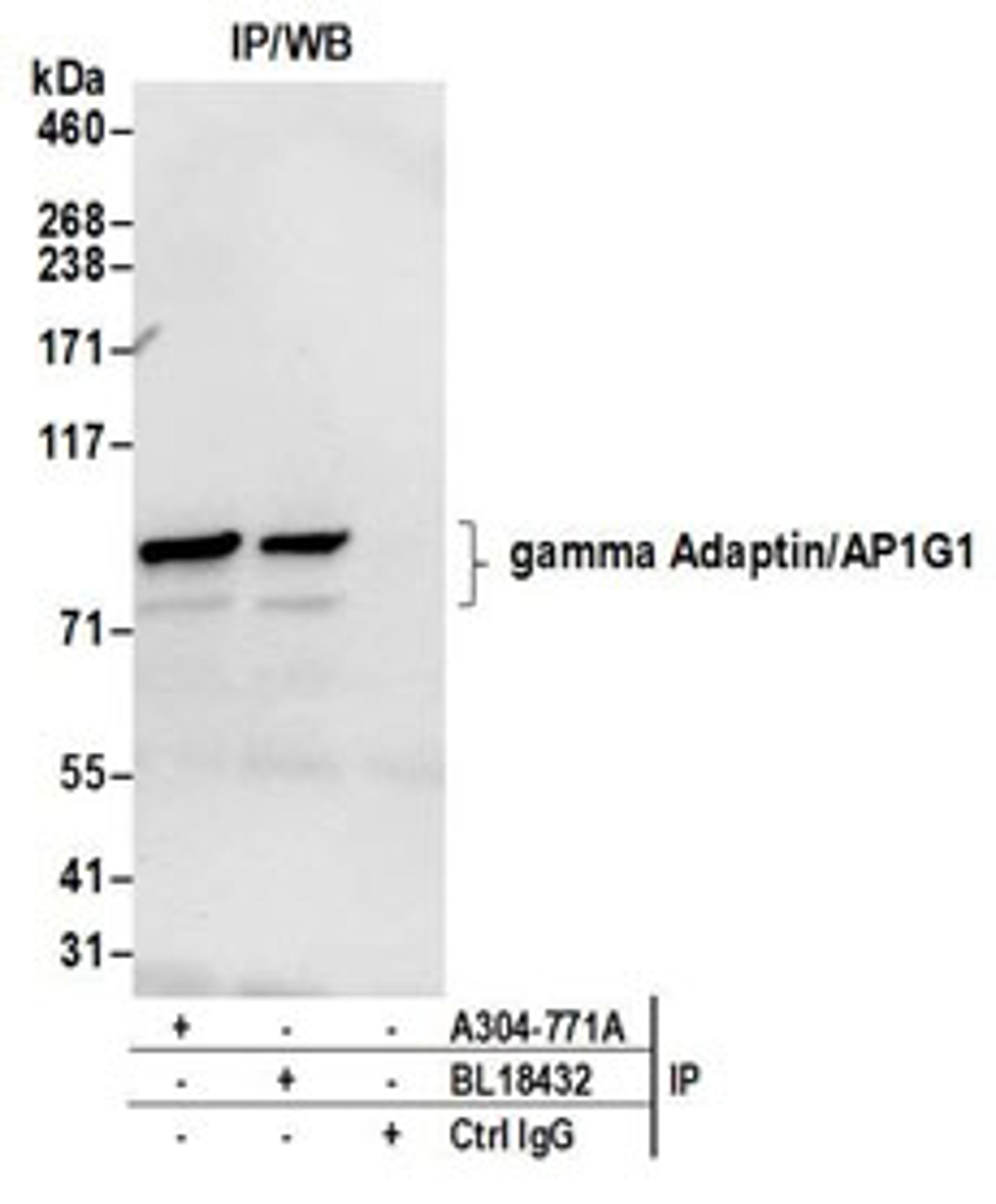 Detection of human gamma Adaptin/AP1G1 by western blot of immunoprecipitates.