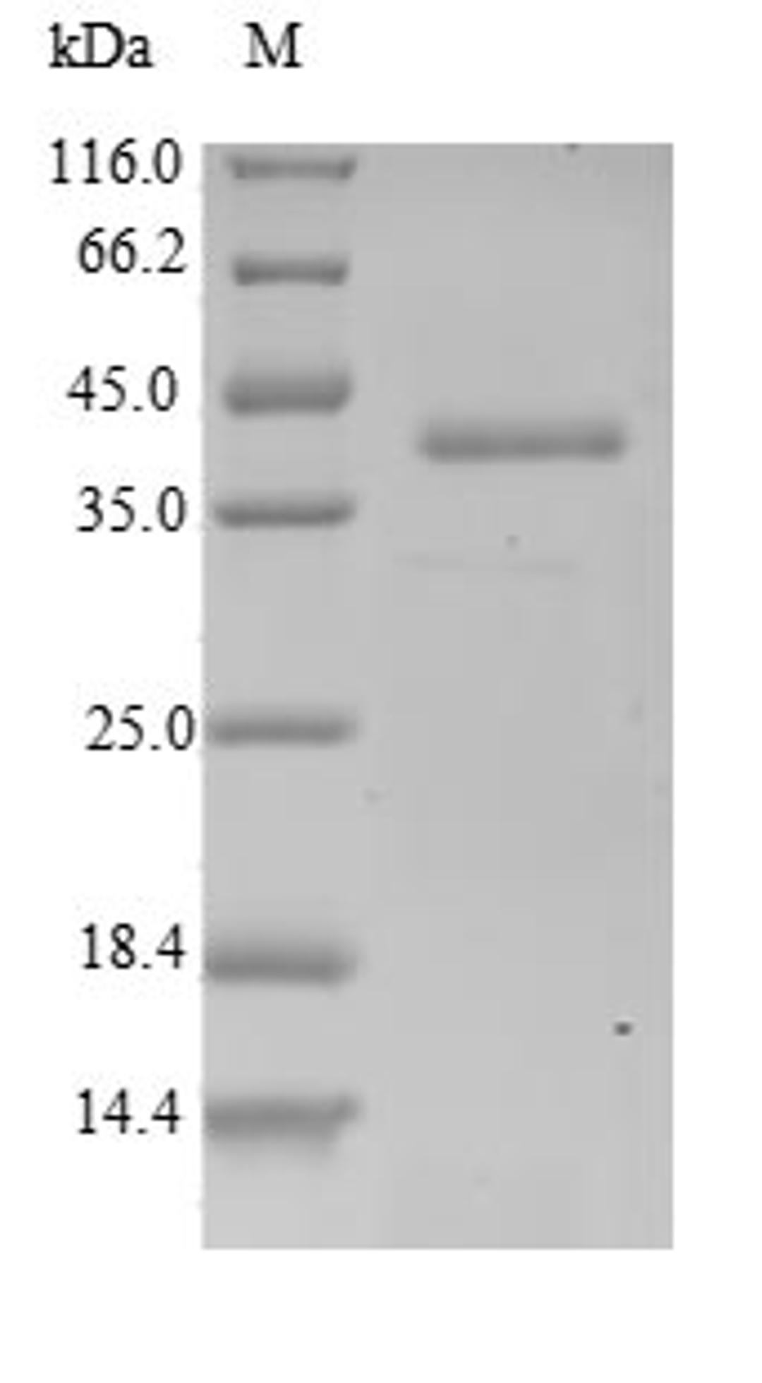 (Tris-Glycine gel) Discontinuous SDS-PAGE (reduced) with 5% enrichment gel and 15% separation gel.