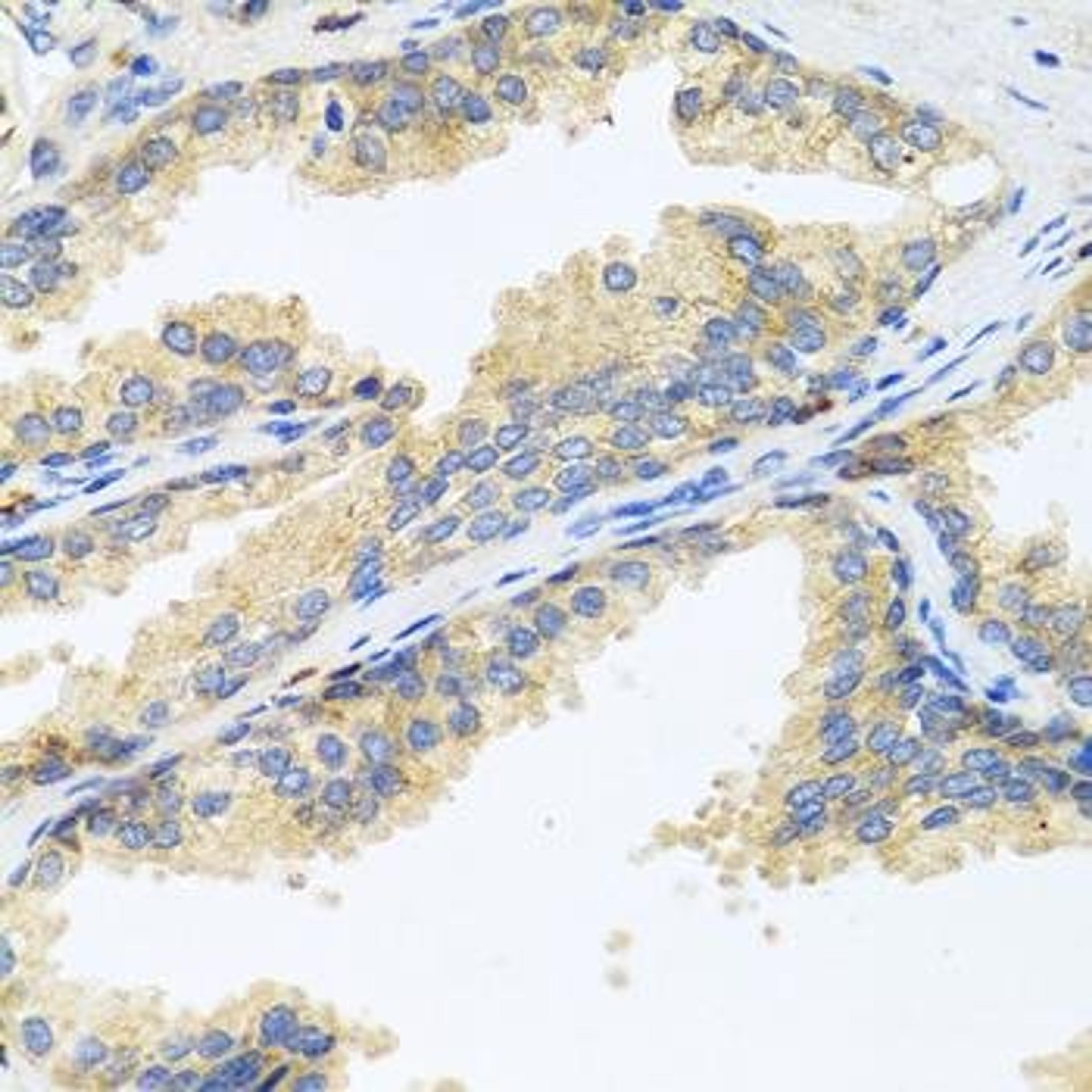 Immunohistochemical staining of rat heart tissue using WFDC2 antibody (dilution of 1:100)