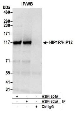 Detection of human HIP1R/HIP12 by western blot of immunoprecipitates.