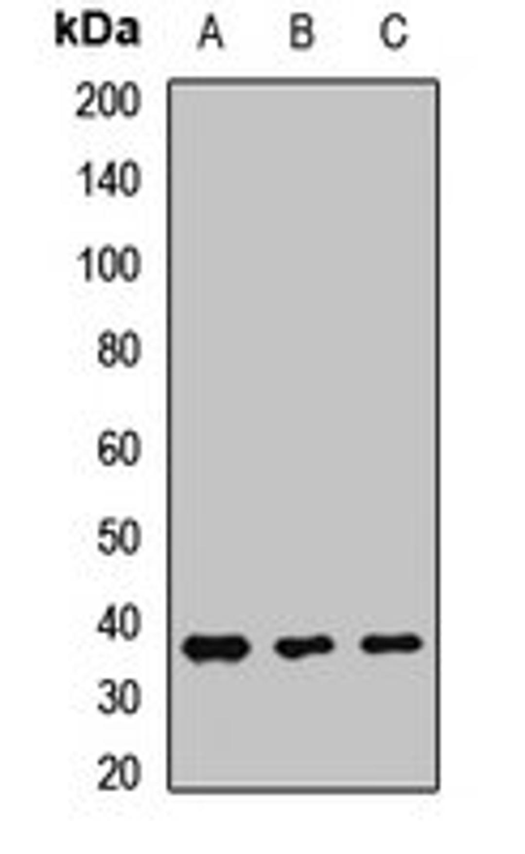 Western blot analysis of Jurkat (Lane1), MCF7 (Lane2), THP1 (Lane3) whole cell lysates using EMB antibody