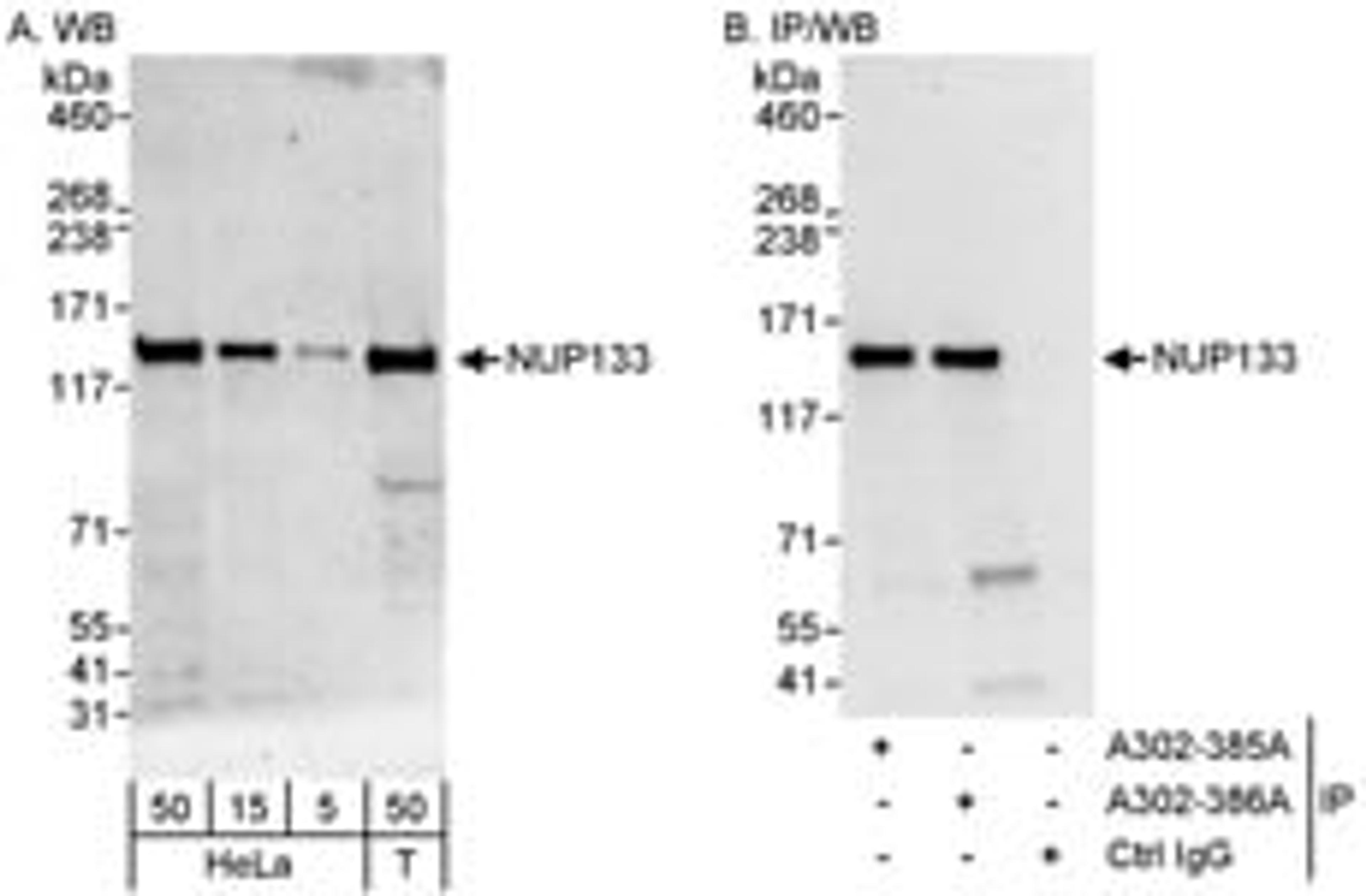 Detection of human NUP133 by western blot and immunoprecipitation.