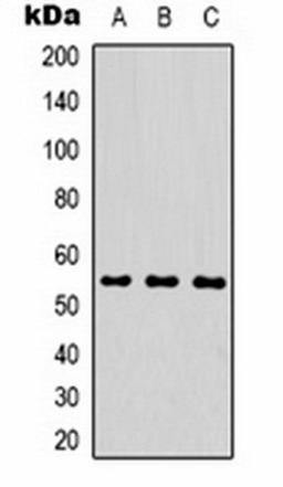 Western blot analysis of MCF7 (Lane 1), mouse brain (Lane 2), rat brain (Lane 3) whole cell lysates using MICU1 antibody