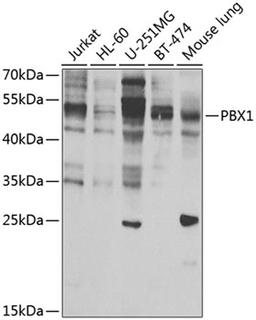 Western blot - PBX1 antibody (A7567)