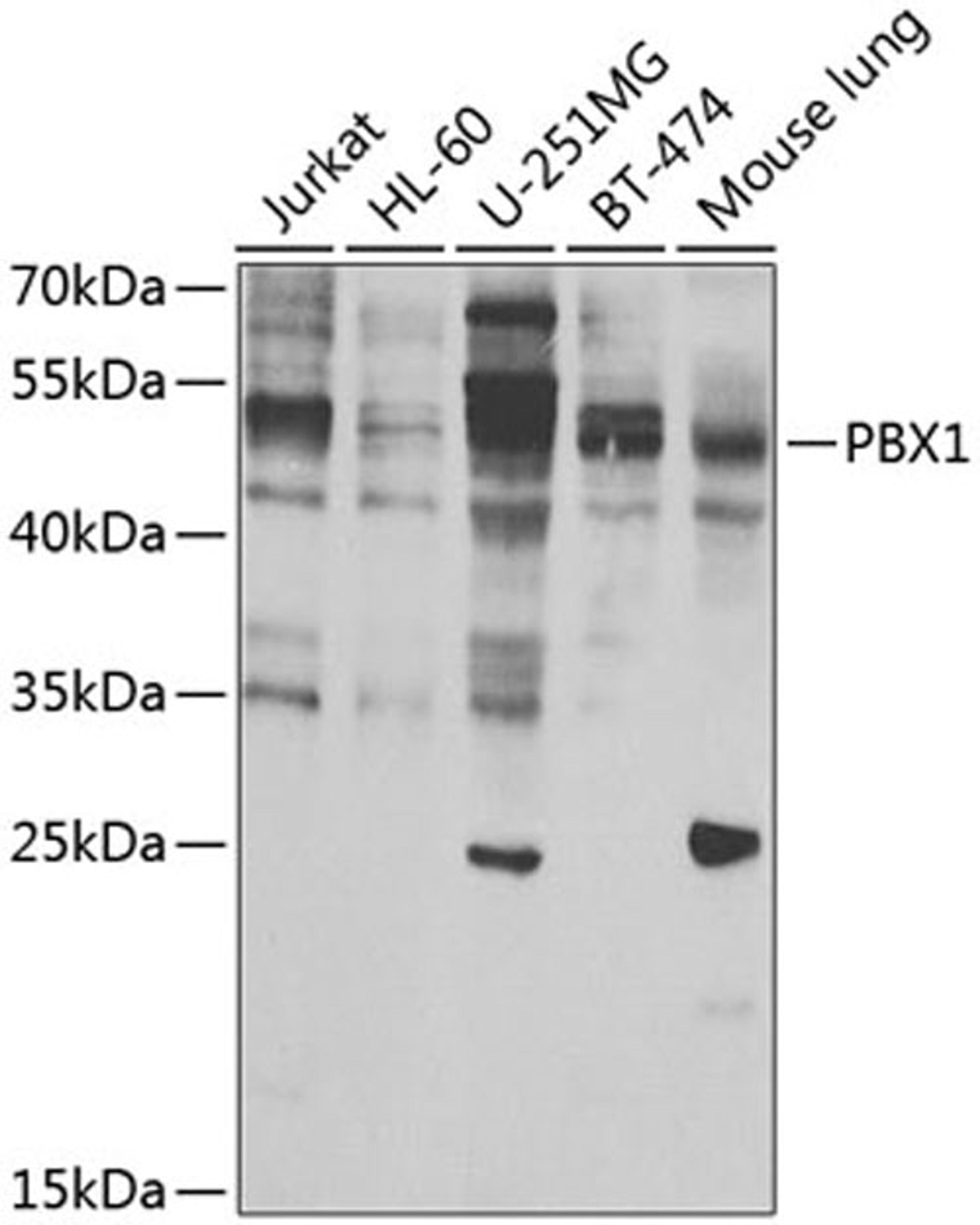 Western blot - PBX1 antibody (A7567)