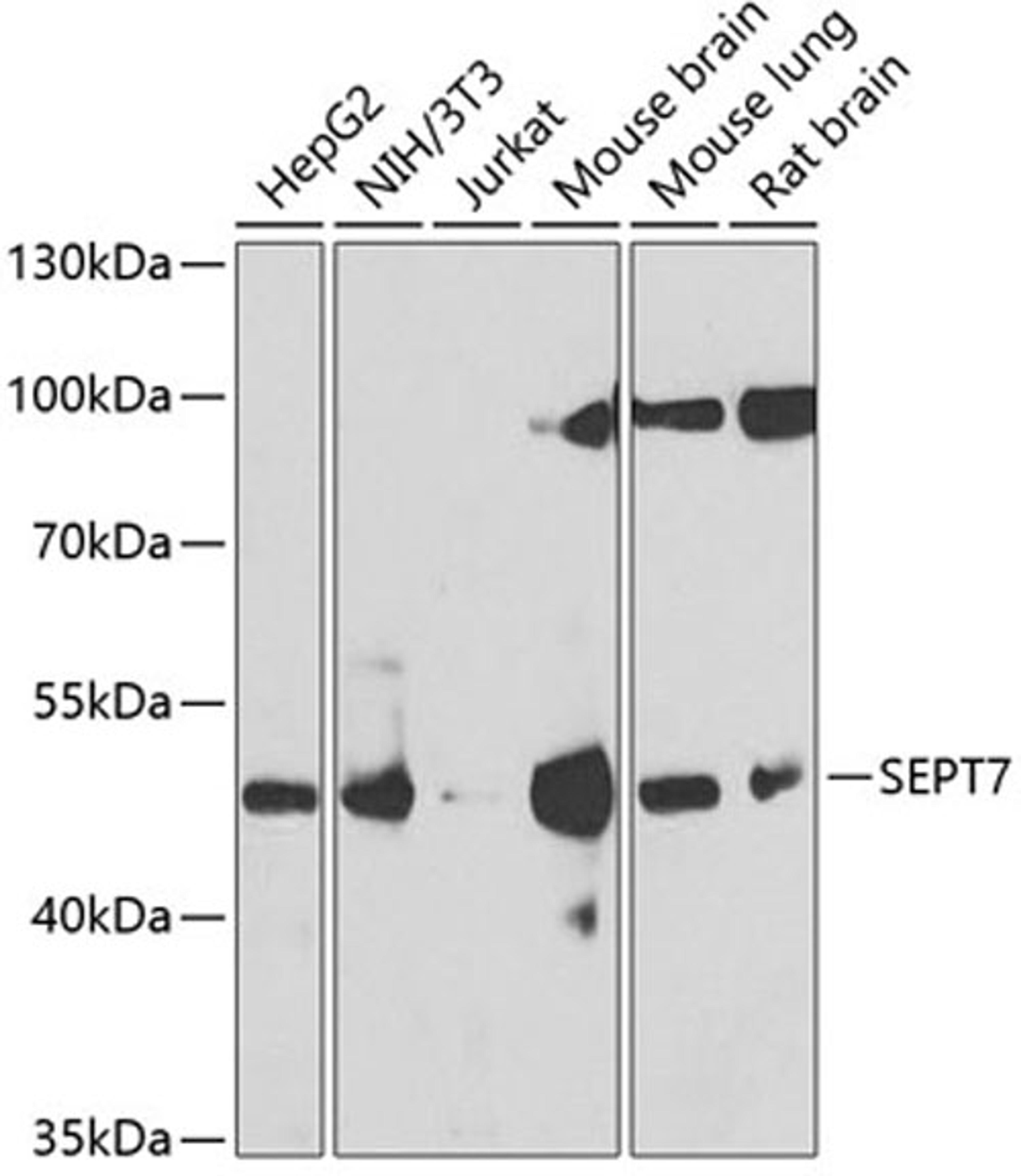 Western blot - SEPT7 antibody (A6883)