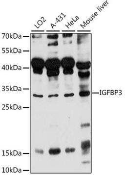 Western blot - IGFBP3 antibody (A16052)