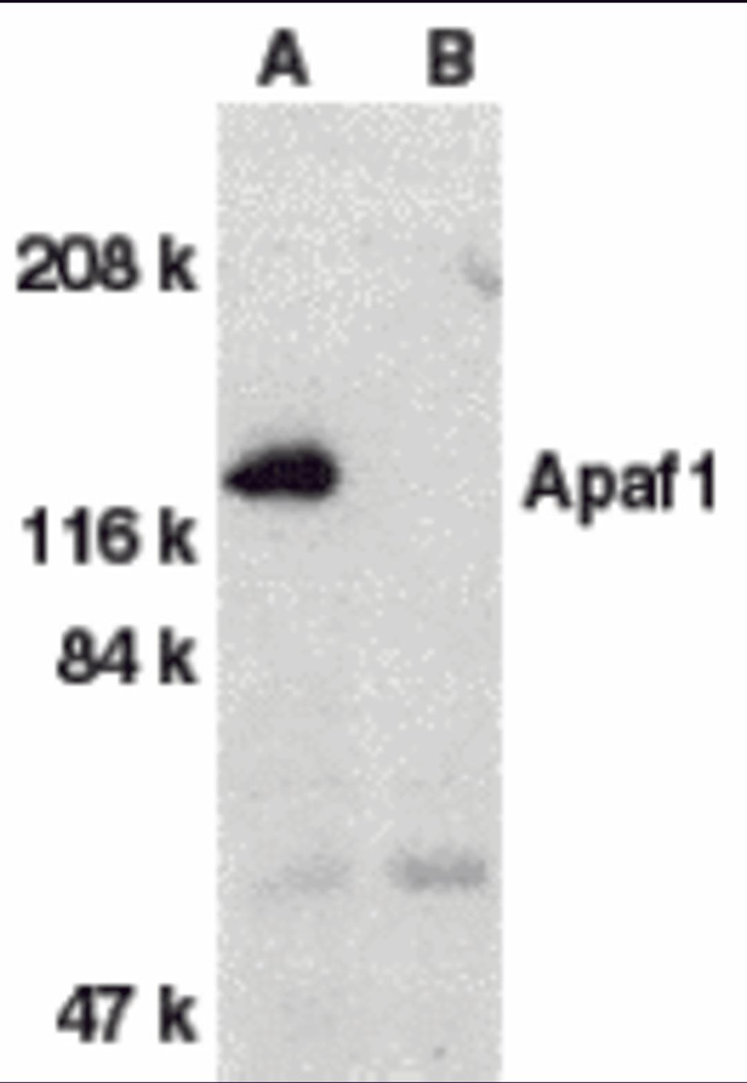 Western blot analysis of Apaf1 in human heart tissue lysate with Apaf1 antibody at 1 μg/mL dilution in the absence (A) or presence (B) of blocking peptide.