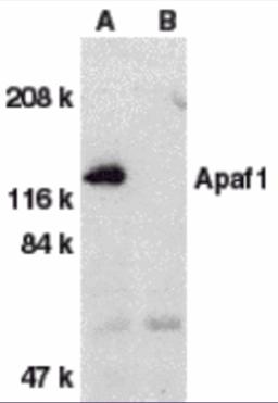 Western blot analysis of Apaf1 in human heart tissue lysate with Apaf1 antibody at 1 μg/mL dilution in the absence (A) or presence (B) of blocking peptide.