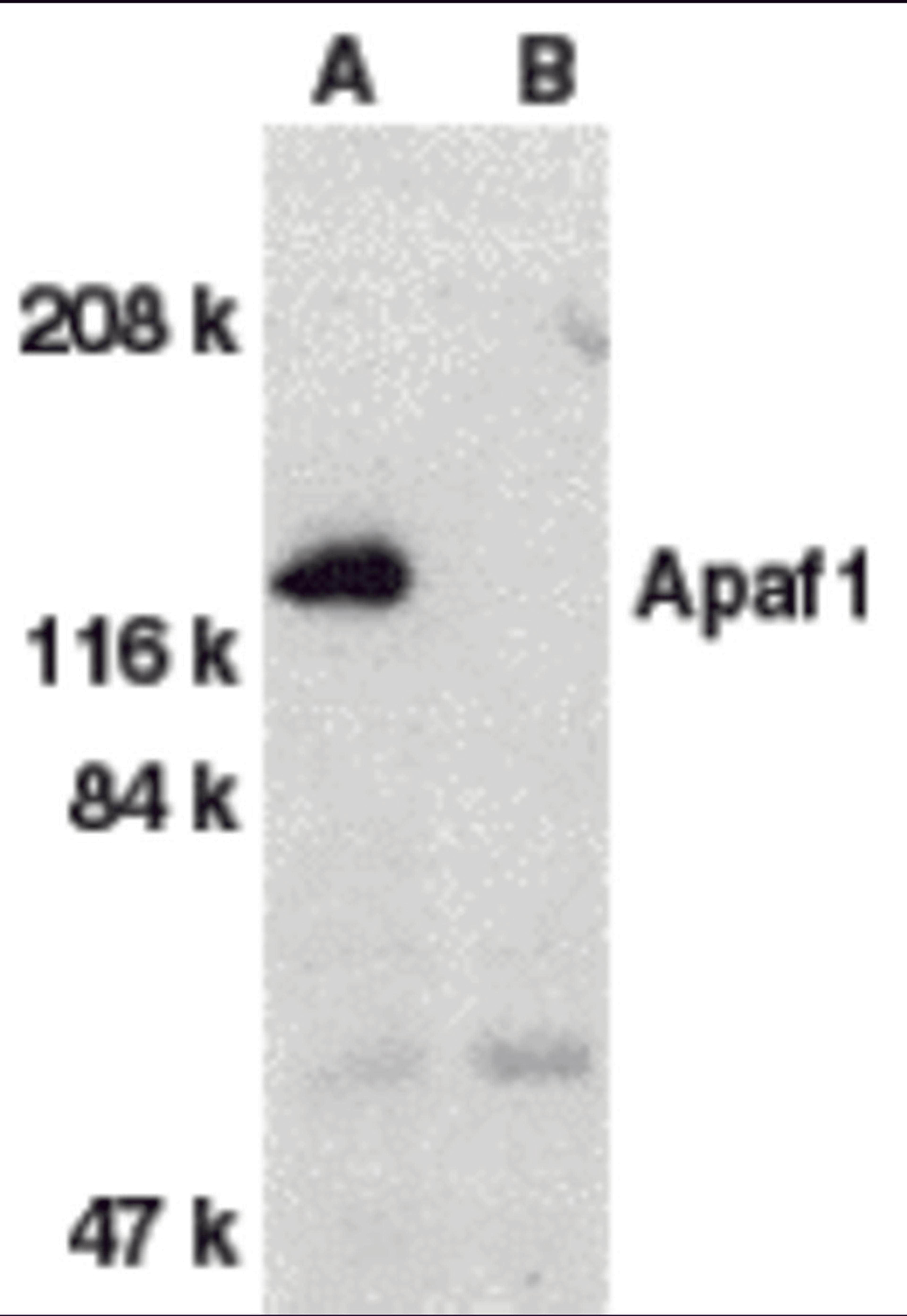 Western blot analysis of Apaf1 in human heart tissue lysate with Apaf1 antibody at 1 μg/mL dilution in the absence (A) or presence (B) of blocking peptide.