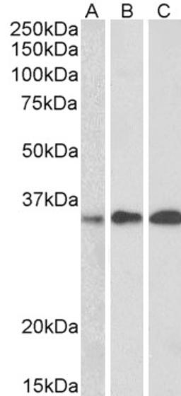 46-454 (0.5ug/ml) staining of Human Thymus, Human Lymph node and Human Tonsil lysate (35ug protein in RIPA buffer). Primary incubation was 1 hour. Detected by chemiluminescence.