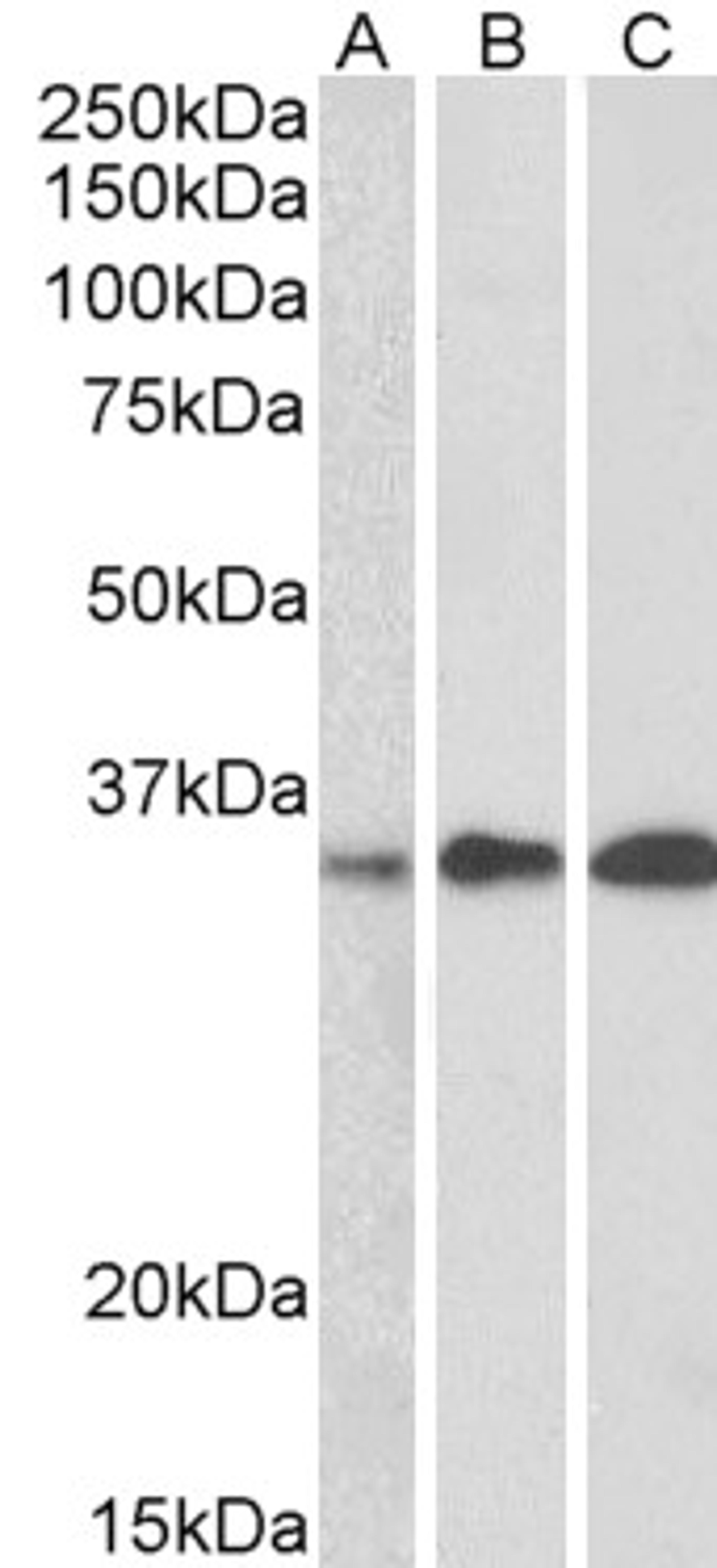 46-454 (0.5ug/ml) staining of Human Thymus, Human Lymph node and Human Tonsil lysate (35ug protein in RIPA buffer). Primary incubation was 1 hour. Detected by chemiluminescence.