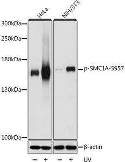 Western blot - Phospho-SMC1A-S957 antibody (AP0090)