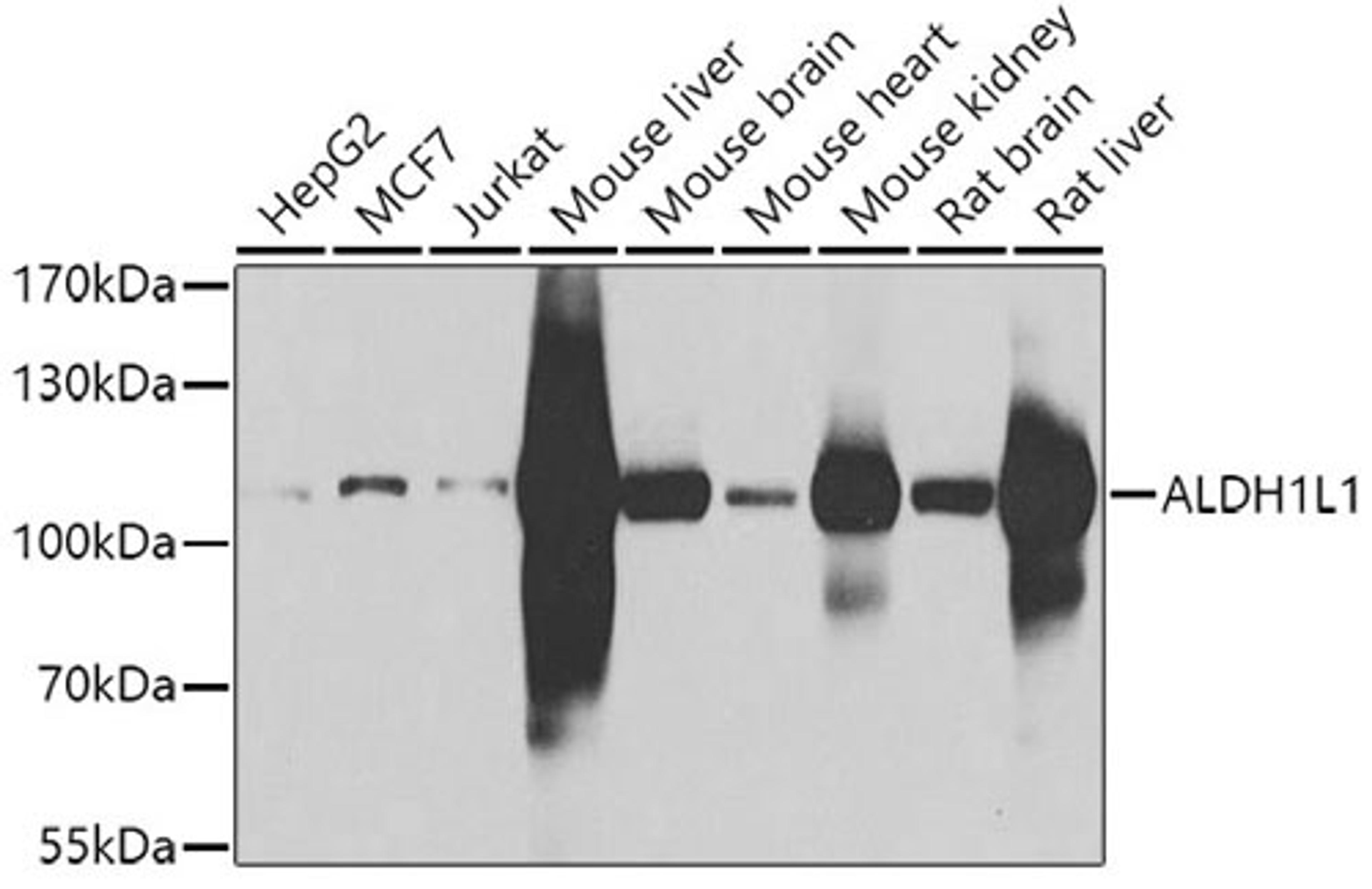 Western blot - ALDH1L1 antibody (A7067)