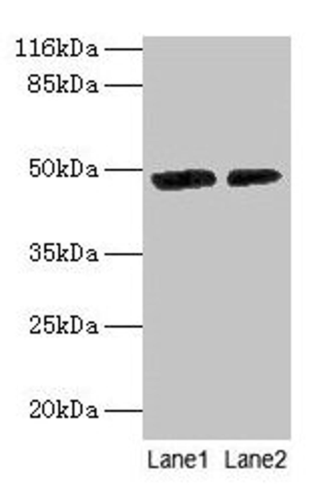 Western blot. All lanes: CALR antibody at 2µg/ml. Lane 1: EC109 whole cell lysate. Lane 2: 293T whole cell lysate. Secondary. Goat polyclonal to rabbit IgG at 1/10000 dilution. Predicted band size: 49 kDa. Observed band size: 49 kDa