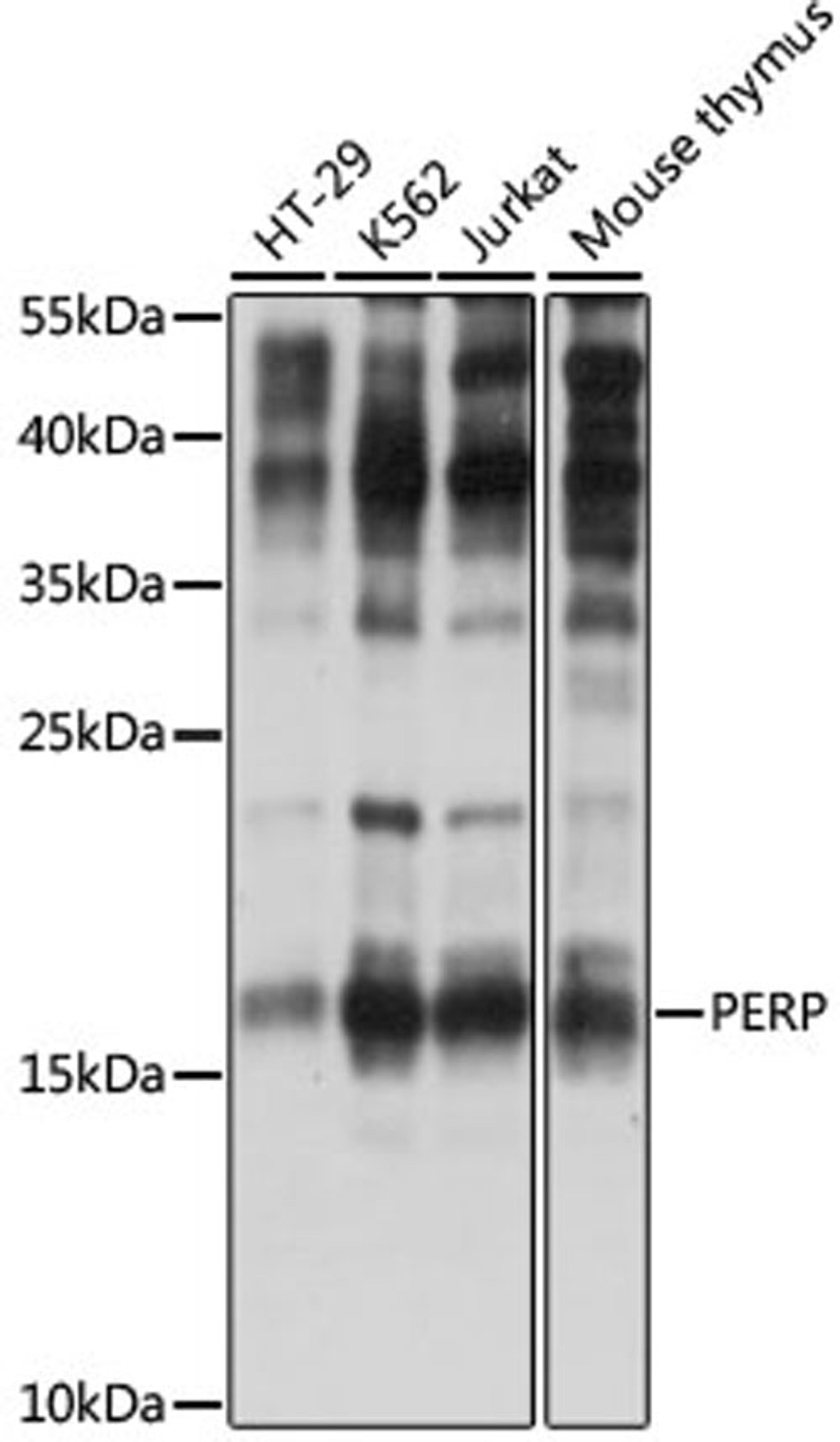 Western blot - PERP antibody (A15501)