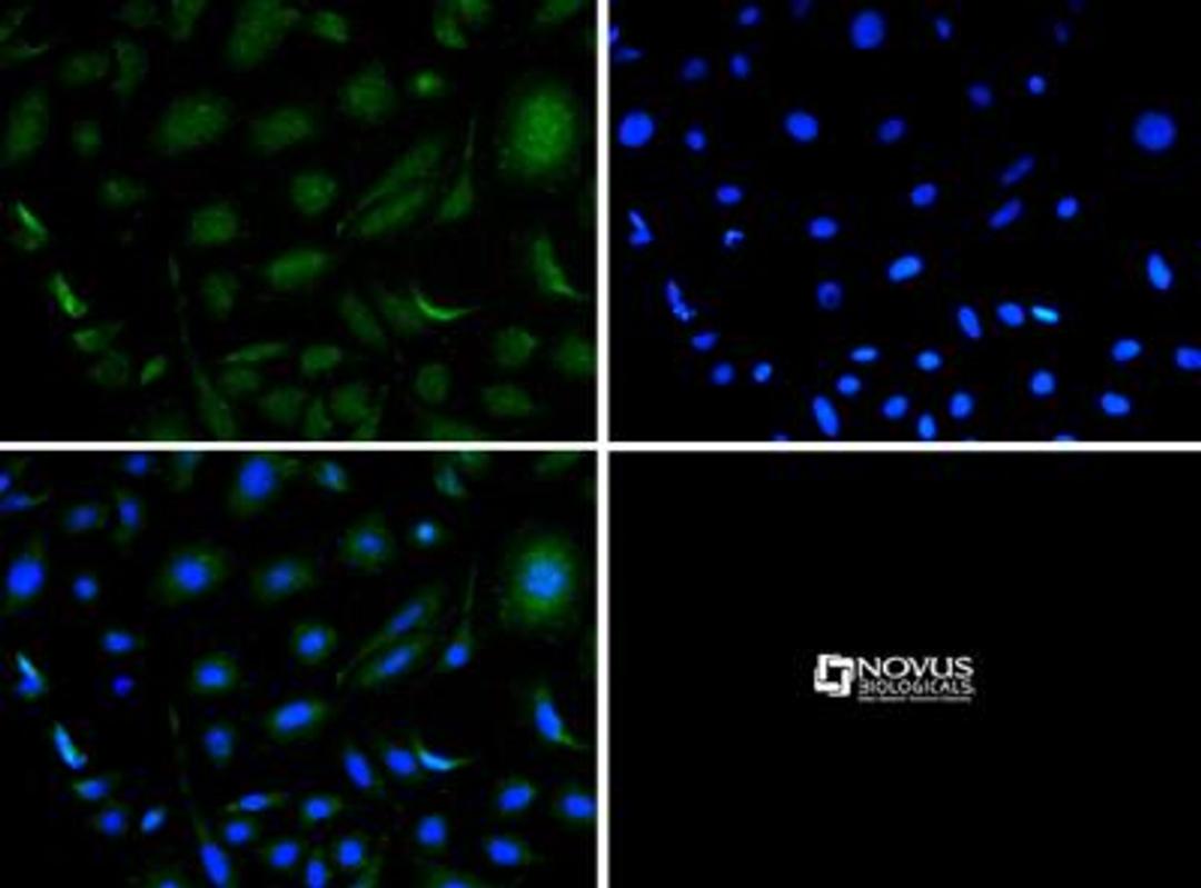 Immunocytochemistry/Immunofluorescence: P2Y2 Antibody [NB110-39032] - P2Y2 antibody was tested in PC12 cells with FITC (green). Nuclei and alpha-tubulin were counterstained with DAPI (blue) and Dylight 550 (red). Membrane staining was observed.