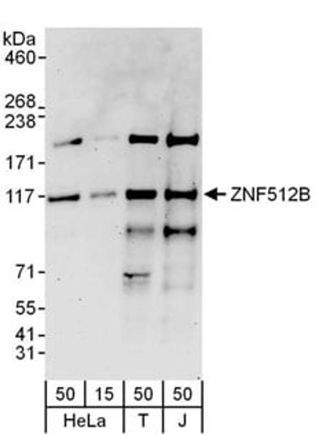 Detection of human ZNF512B by western blot.