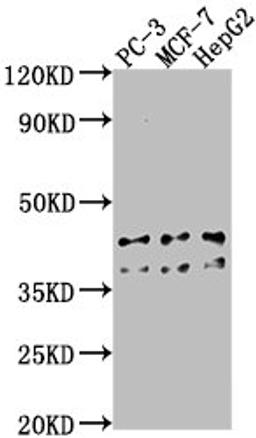 Western Blot. Positive WB detected in: PC-3 whole cell lysate, MCF-7 whole cell lysate, HepG2 whole cell lysate. All lanes: RHBDD3 antibody at 1:1000. Secondary. Goat polyclonal to rabbit IgG at 1/50000 dilution. Predicted band size: 41 kDa. Observed band size: 41 kDa.
