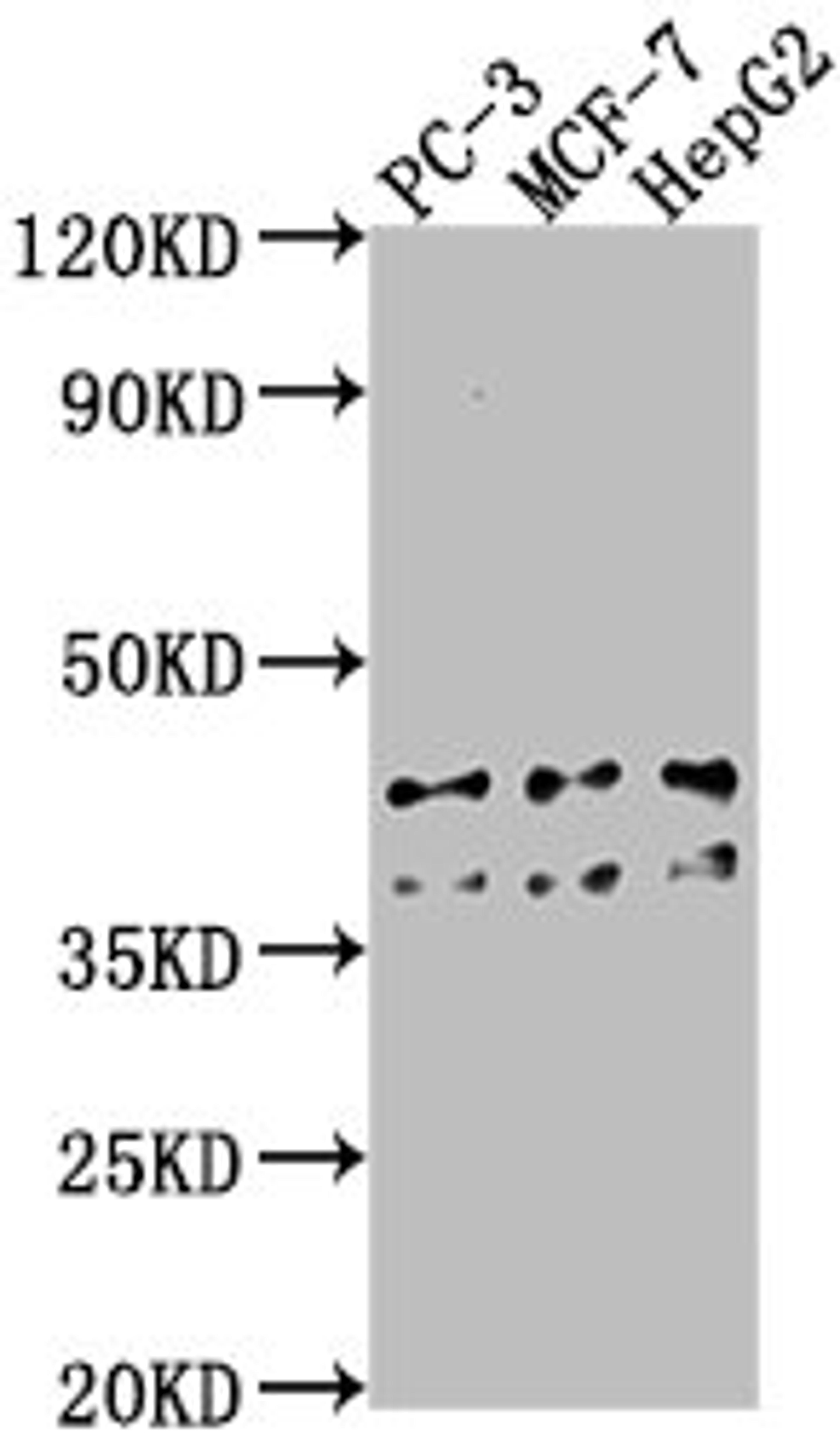 Western Blot. Positive WB detected in: PC-3 whole cell lysate, MCF-7 whole cell lysate, HepG2 whole cell lysate. All lanes: RHBDD3 antibody at 1:1000. Secondary. Goat polyclonal to rabbit IgG at 1/50000 dilution. Predicted band size: 41 kDa. Observed band size: 41 kDa.