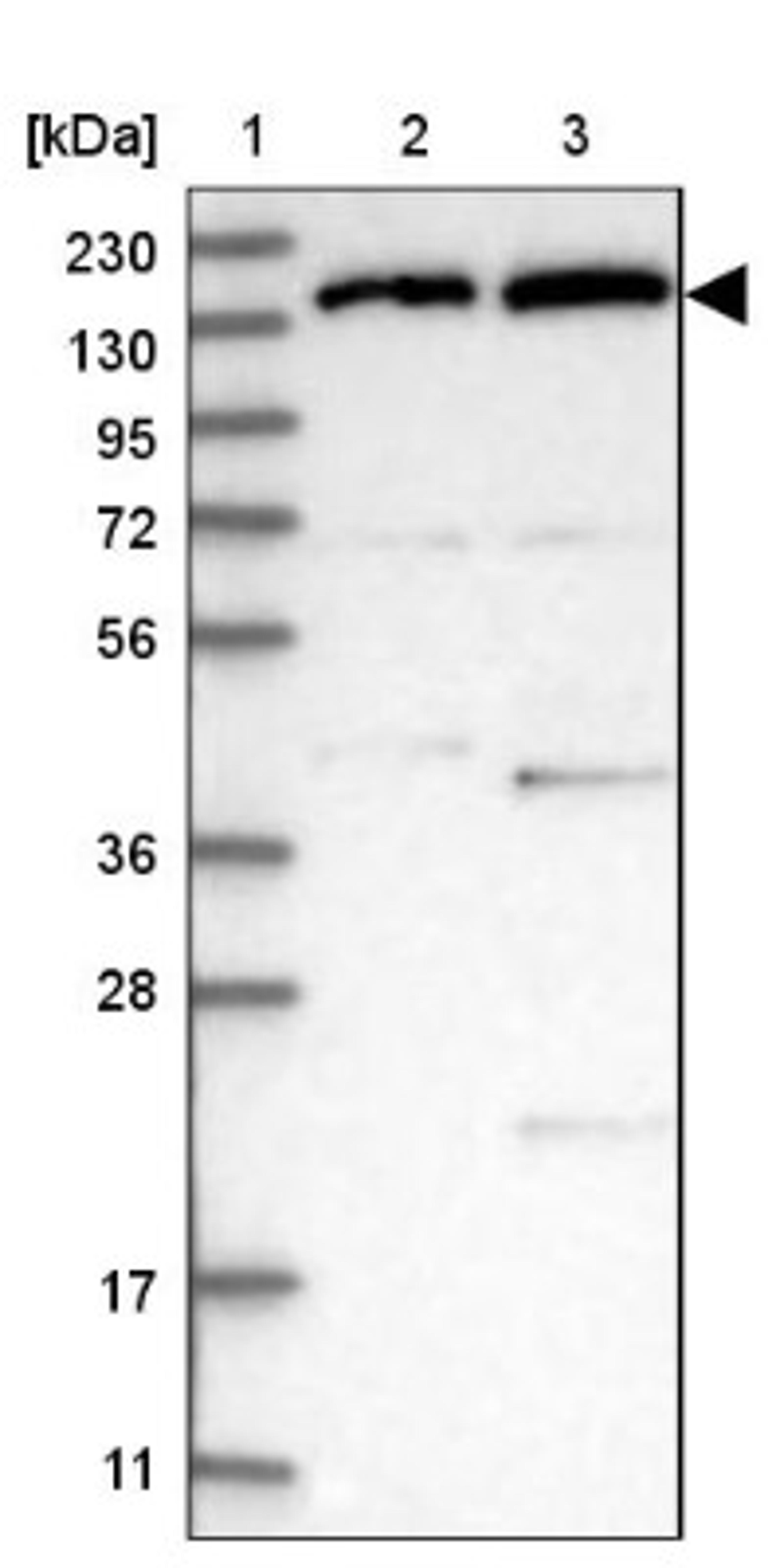 Western Blot: RPB2 Antibody [NBP1-87786] - Lane 1: Marker [kDa] 230, 130, 95, 72, 56, 36, 28, 17, 11<br/>Lane 2: Human cell line RT-4<br/>Lane 3: Human cell line U-251MG sp