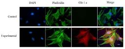 Immunocytochemistry/Immunofluorescence: Glyoxalase I Antibody (Glo1a) [NBP1-19015] - Immunostaining of human retinal endothelial cells. Immunoreactivity for hGlx-1 was detected in human retinal endothelial cells stained with Glo1a mAb using anti mouse IgG Texas Red as secondary Ab. The cells were counter stained with phalloidin (green) and DAPI (blue), nuclear stain. No reactivity was detected in control cells, stained without Go1a mAb. Figure is a representative of 3 independent experiments. Photo courtesy of Dr. Nagaraj, Case Western Reserve University.