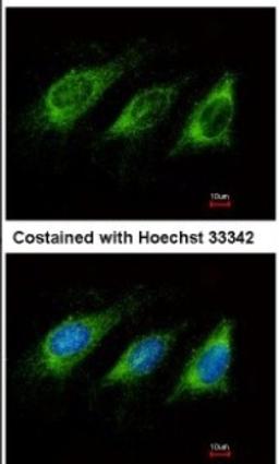 Immunocytochemistry/Immunofluorescence: AICDA Antibody [NBP1-30955] - Analysis of methanol-fixed HeLa, using antibody at 1:500 dilution.