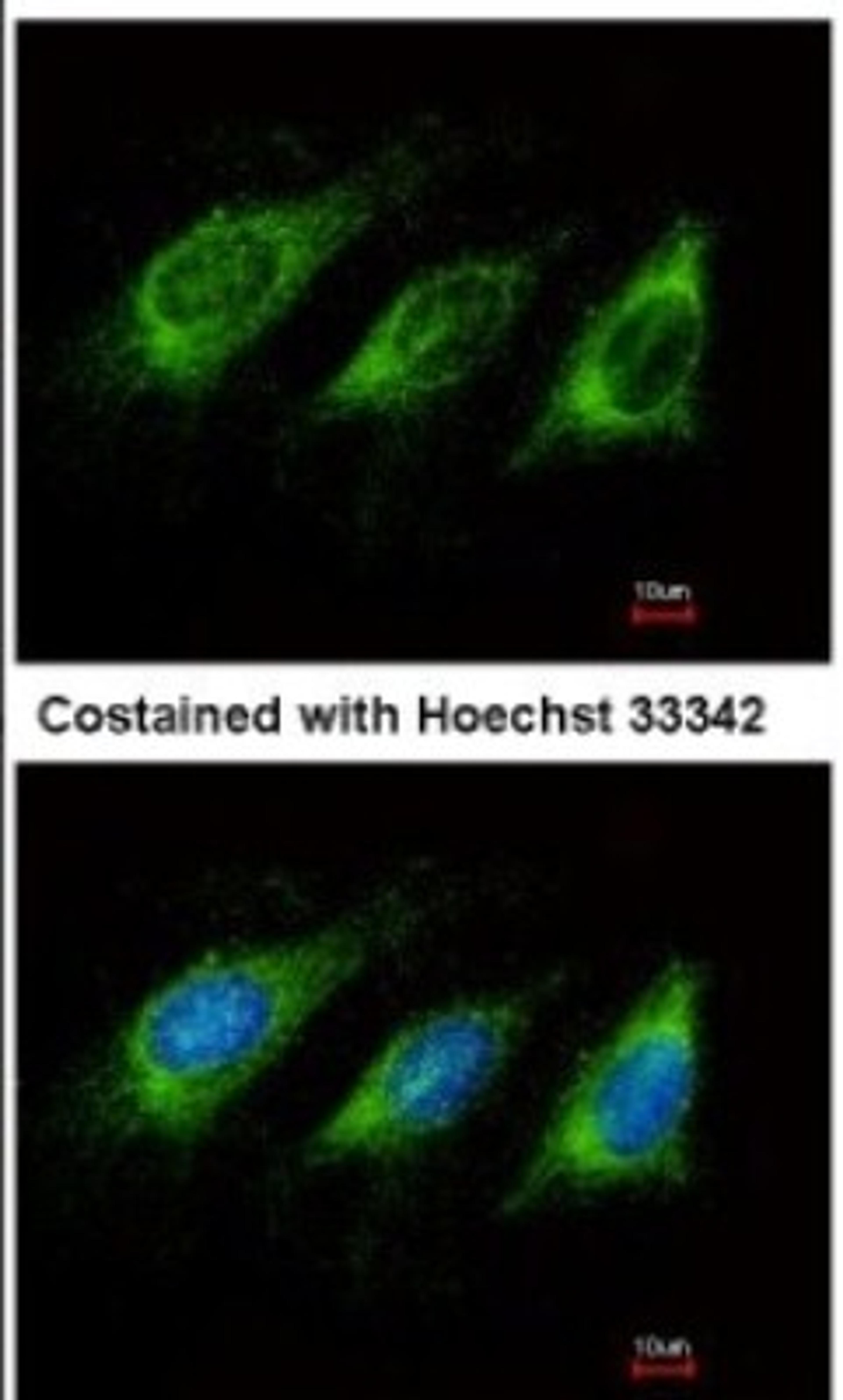 Immunocytochemistry/Immunofluorescence: AICDA Antibody [NBP1-30955] - Analysis of methanol-fixed HeLa, using antibody at 1:500 dilution.