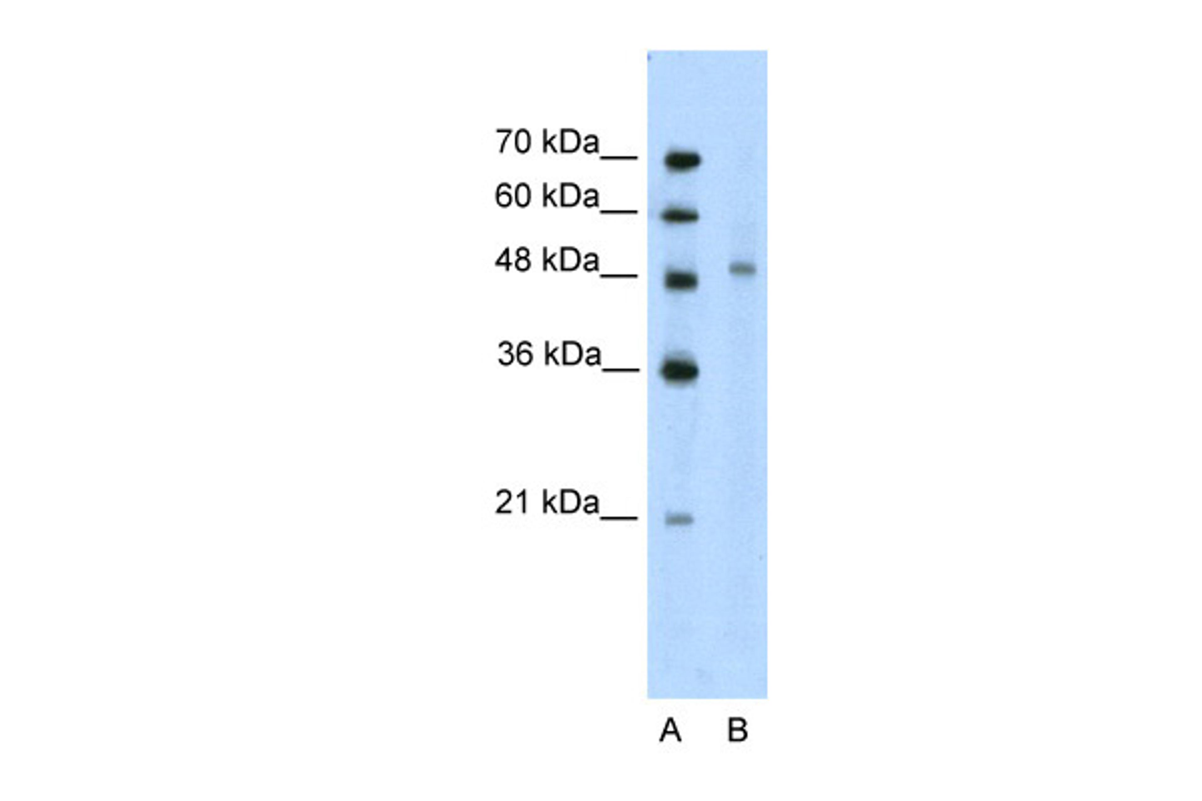 Antibody used in WB on Human Jurkat 2.5 ug/ml.