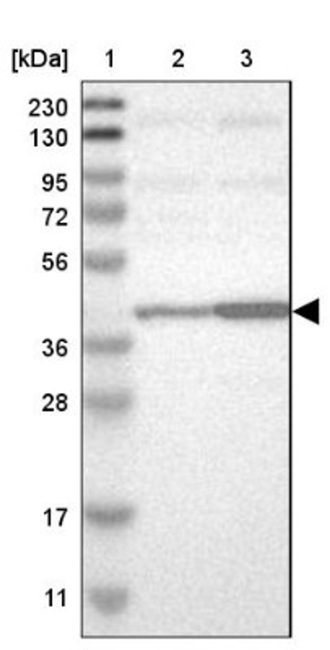 Western Blot: Actin Regulatory Protein Antibody [NBP1-90215] - Lane 1: Marker [kDa] 230, 130, 95, 72, 56, 36, 28, 17, 11<br/>Lane 2: Human cell line RT-4<br/>Lane 3: Human cell line U-251MG sp