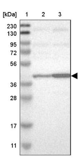 Western Blot: Actin Regulatory Protein Antibody [NBP1-90215] - Lane 1: Marker [kDa] 230, 130, 95, 72, 56, 36, 28, 17, 11<br/>Lane 2: Human cell line RT-4<br/>Lane 3: Human cell line U-251MG sp