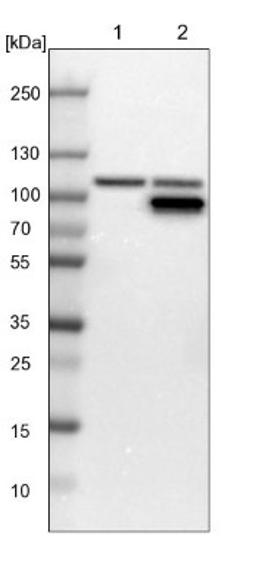 Western Blot: GART Antibody [NBP1-87290] - Lane 1: NIH-3T3 cell lysate (Mouse embryonic fibroblast cells)<br/>Lane 2: NBT-II cell lysate (Rat Wistar bladder tumour cells)