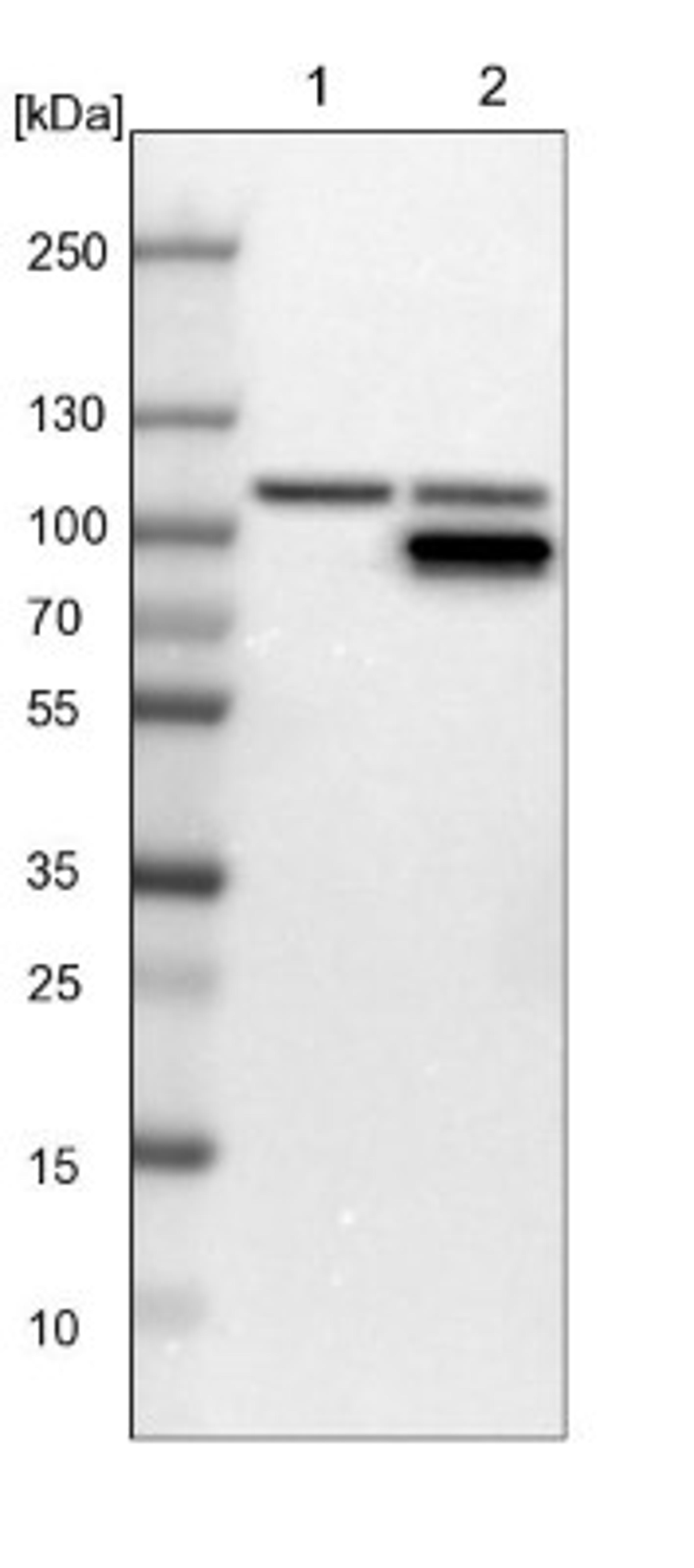 Western Blot: GART Antibody [NBP1-87290] - Lane 1: NIH-3T3 cell lysate (Mouse embryonic fibroblast cells)<br/>Lane 2: NBT-II cell lysate (Rat Wistar bladder tumour cells)