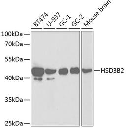 Western blot - HSD3B2 antibody (A1823)