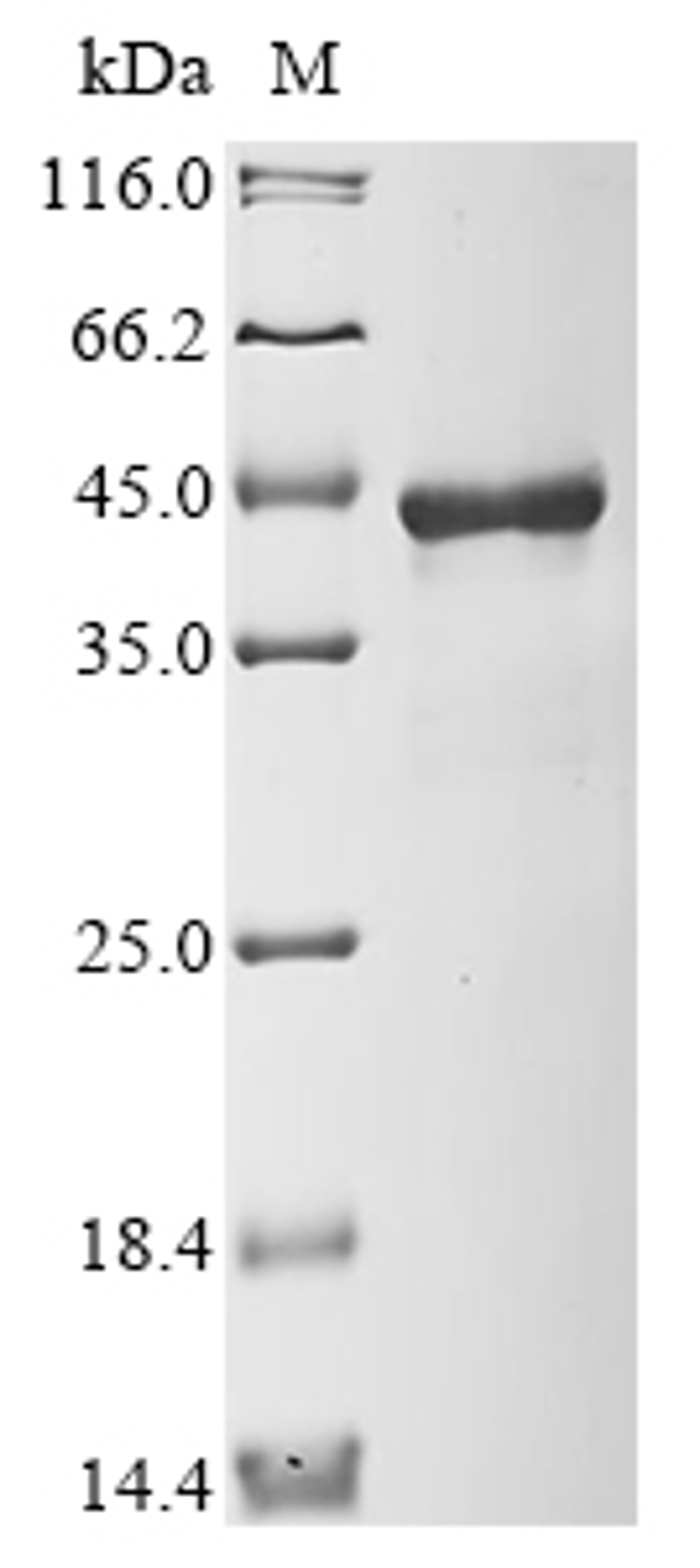 (Tris-Glycine gel) Discontinuous SDS-PAGE (reduced) with 5% enrichment gel and 15% separation gel.