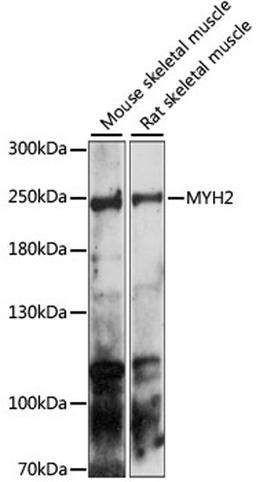 Western blot - MYH2 antibody (A15292)