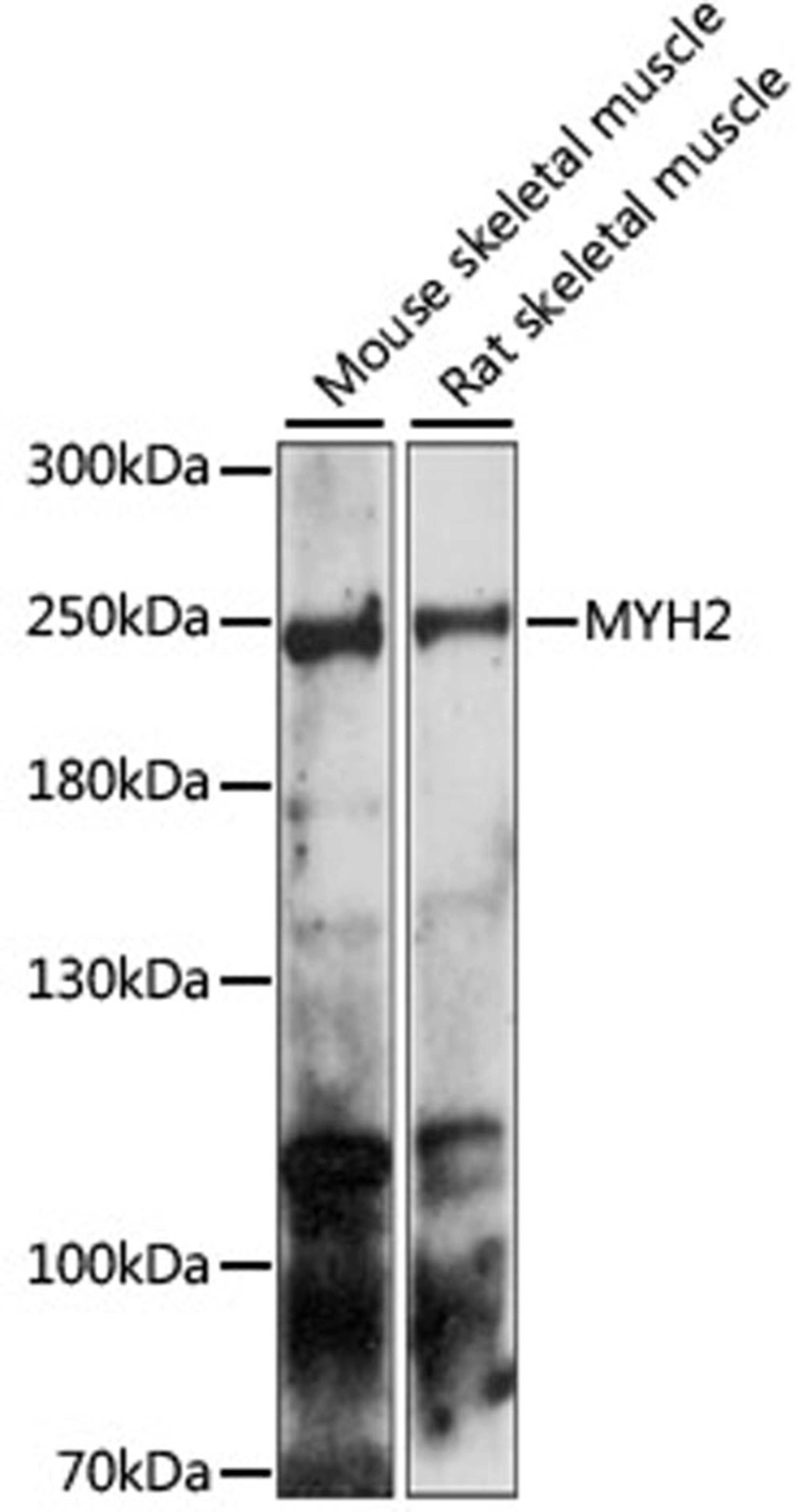 Western blot - MYH2 antibody (A15292)