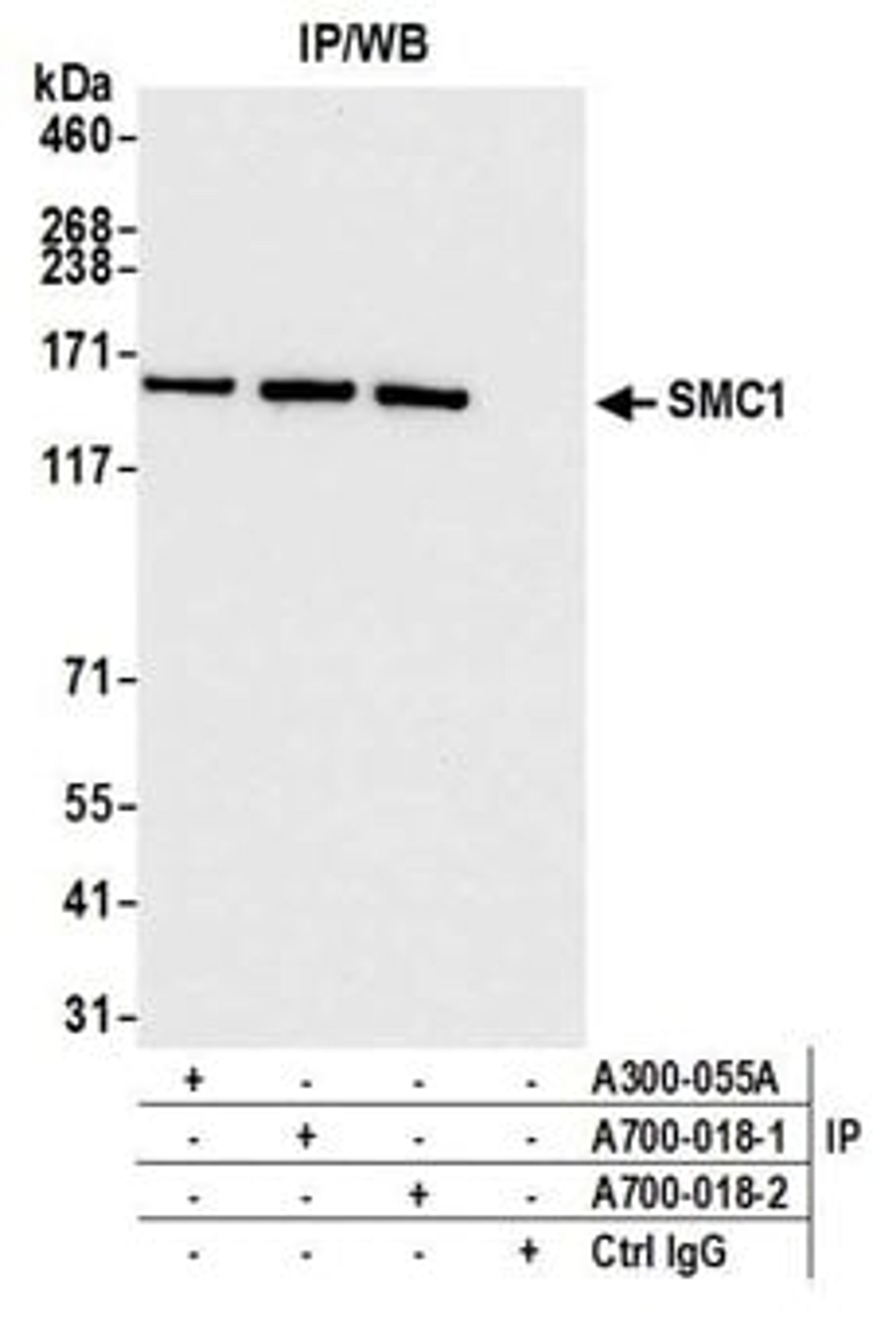 Detection of human SMC1 by western blot of immunoprecipitates.